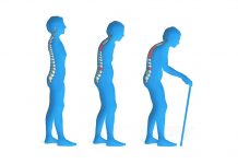 Reduce your risk of Osteoporosis