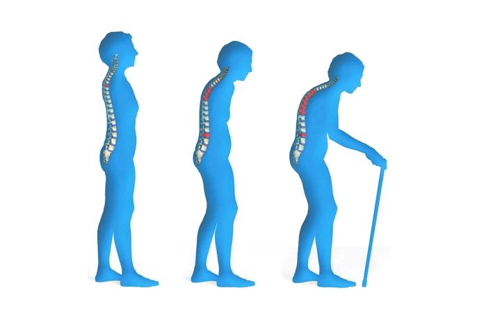 Reduce-your-risk-of-Osteopo